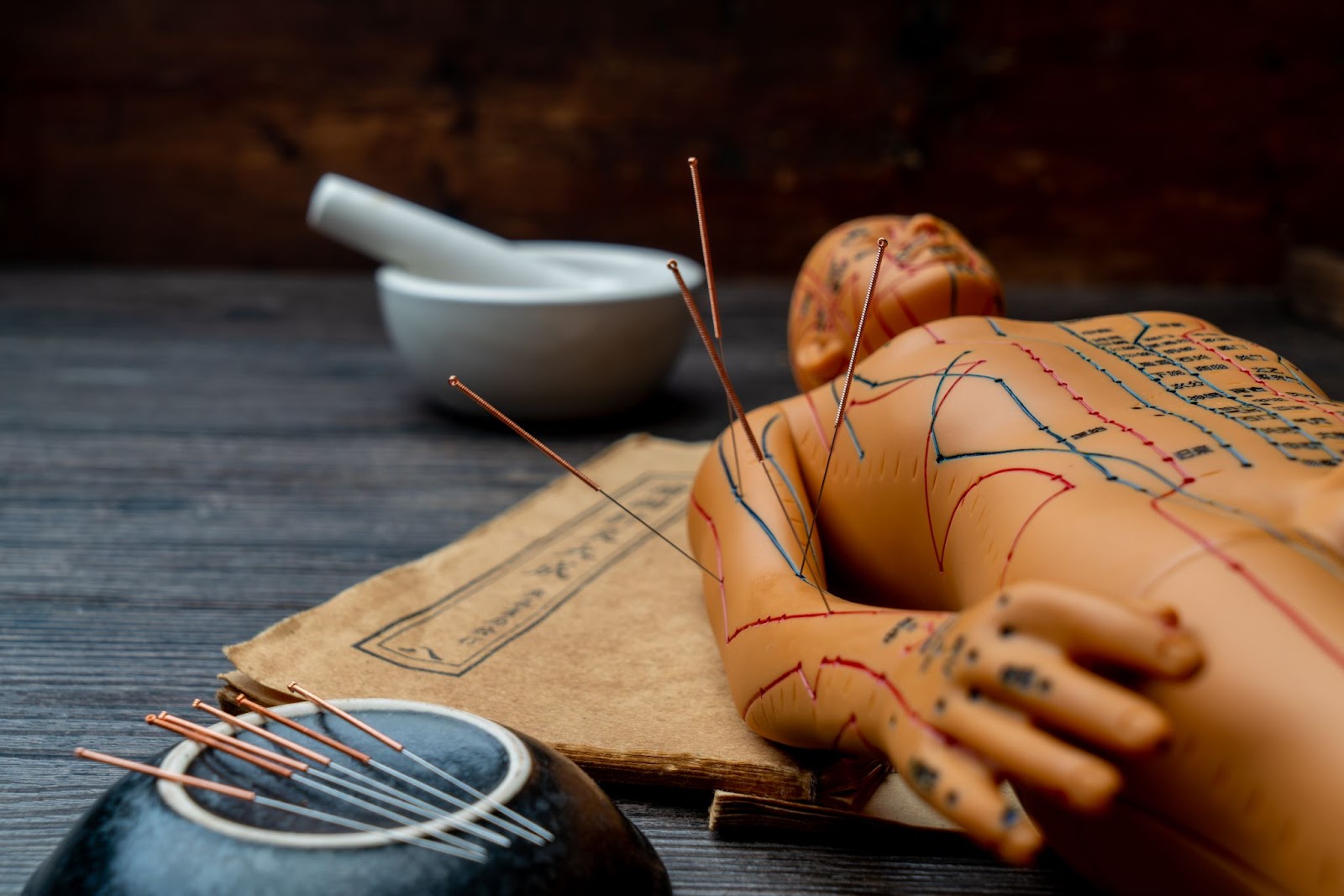 Exploring the Healing Potential of Acupuncture and Traditional Therapies